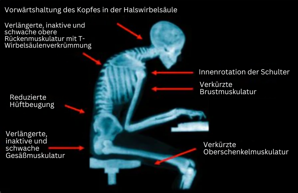 EMS-Posture Bandage - PosturePro