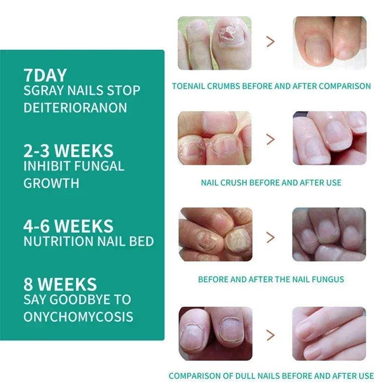 Nail Fungus Defender Serum