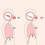 Facial Tightening