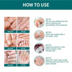 Nail Fungus Defender Serum