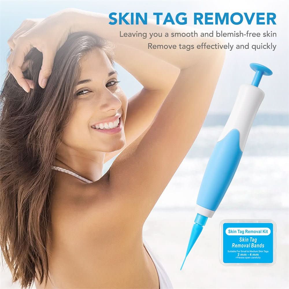 Skin spot remover for warts & skin tags