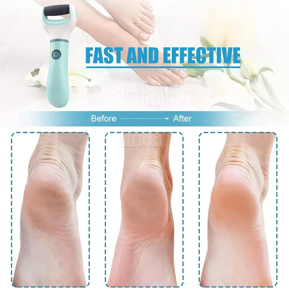 Pedivance Electric Callus Remover with USB Charging | For gentle foot care & pedicure | Removes dry, cracked & calloused skin – 1200 mAh