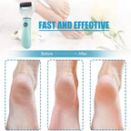 Pedivance Electric Callus Remover with USB Charging | For gentle foot care & pedicure | Removes dry, cracked & calloused skin – 1200 mAh