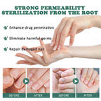 Nail Fungus Defender Serum