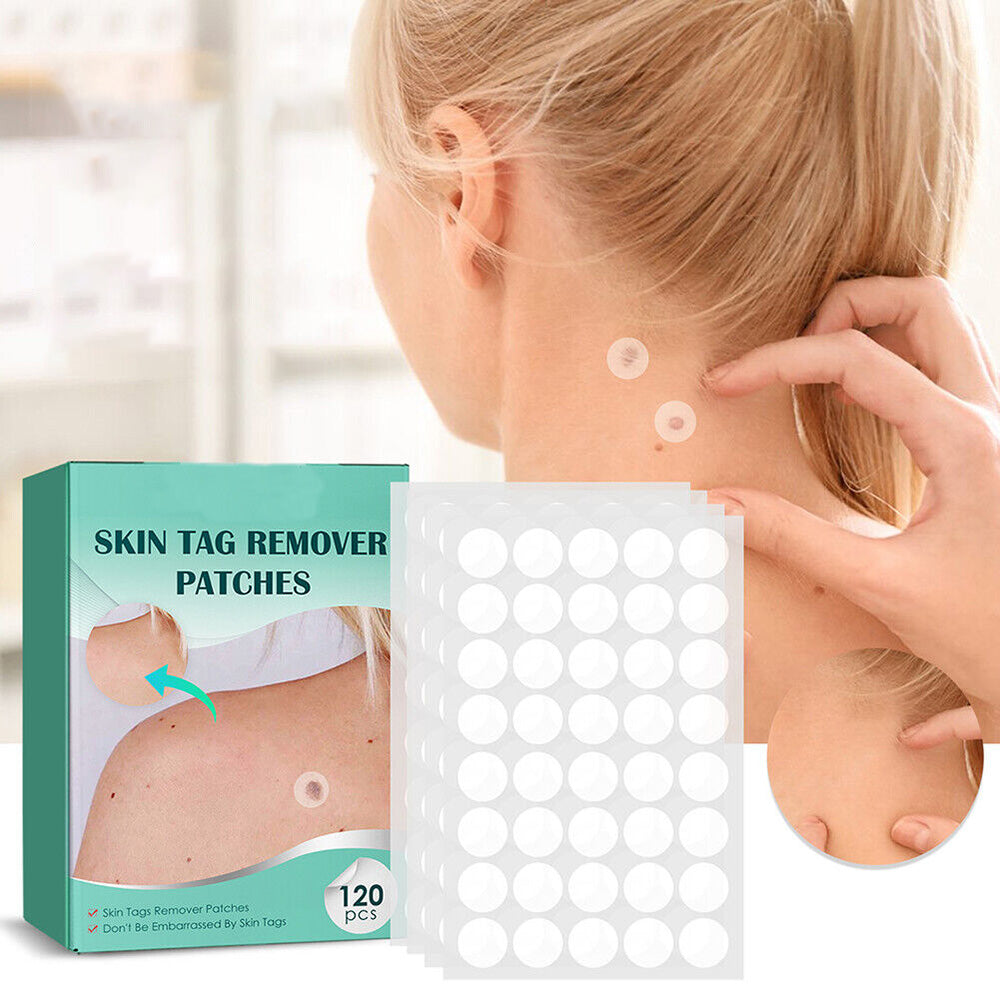 SkinClear - Plaster for the removal of spots and warts