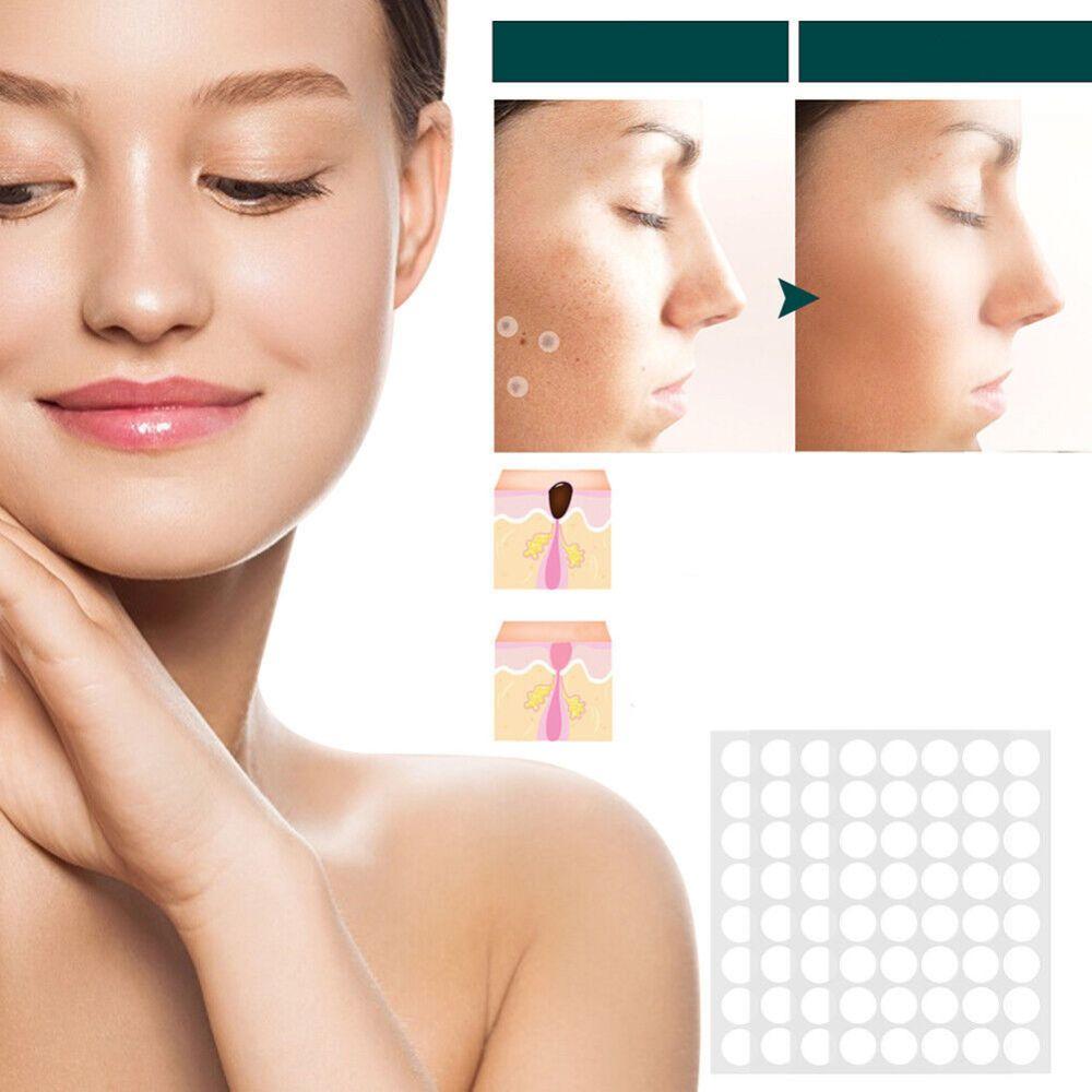 SkinClear - Plaster for the removal of spots and warts