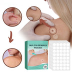 SkinClear - Plaster for the removal of spots and warts