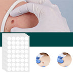 SkinClear - Plaster for the removal of spots and warts
