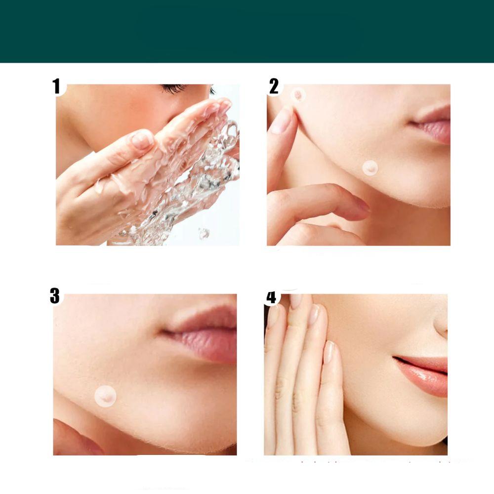 SkinClear - Plaster for the removal of spots and warts