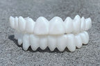 Customizable Dental Prosthesis with Dental Lenses