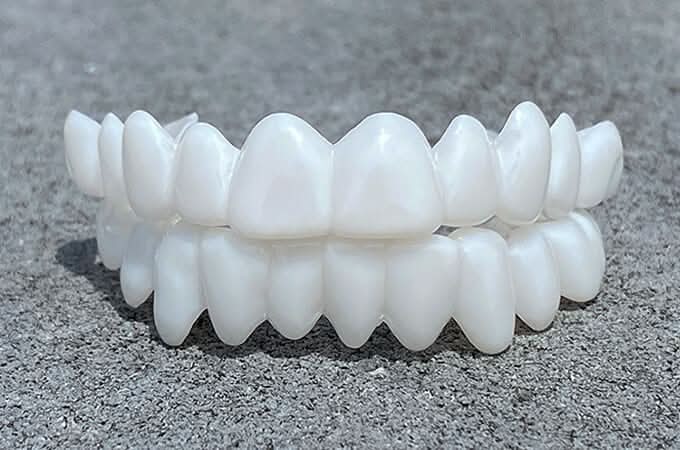 Customizable Dental Prosthesis with Dental Lenses
