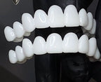 Customizable Dental Prosthesis with Dental Lenses