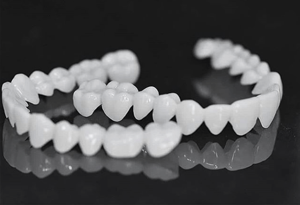 Customizable Dental Prosthesis with Dental Lenses