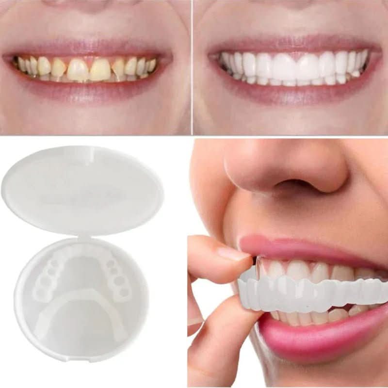 Dental restoration for a bright white smile without a dentist