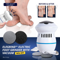 Electric Foot Care Professional | No More Calluses!