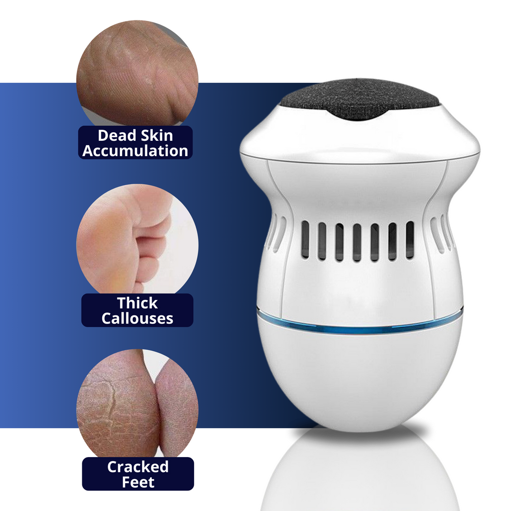 Electric Foot Care Professional | No More Calluses!