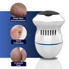 Electric Foot Care Professional | No More Calluses!