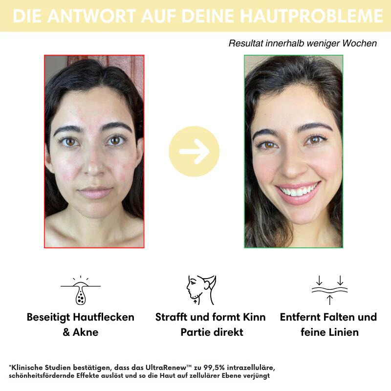 UltraRenew - Youthful Appearance in Just 10 Minutes