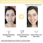 UltraRenew - Youthful Appearance in Just 10 Minutes