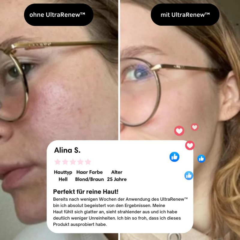 UltraRenew - Youthful Appearance in Just 10 Minutes