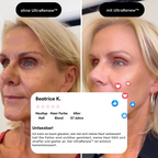 UltraRenew - Youthful Appearance in Just 10 Minutes