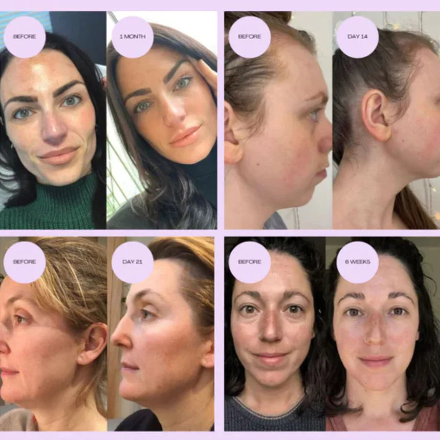 4-in-1 Lumi Lift - improve your skin in 2 days with LED and EMS light therapy