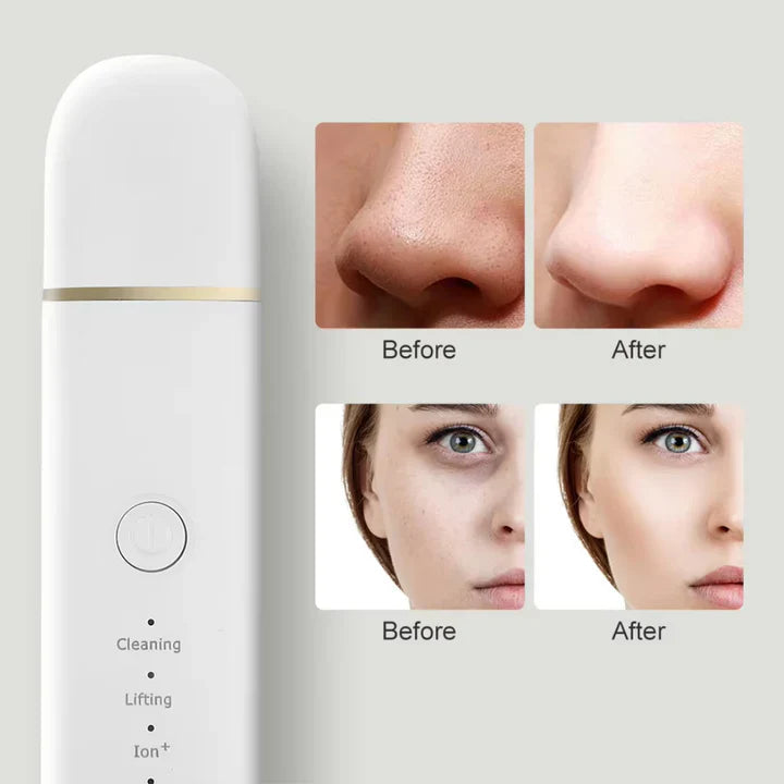 Skin scrubber for deep cleansing