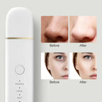 Skin scrubber for deep cleansing