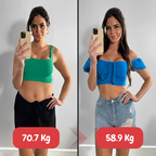 Fat and cellulite remover with ultrasound