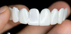 Dental prosthesis with white dental lenses