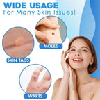 SmoothZap — Pain-free skin freedom for a new sense of confidence in just 10 days