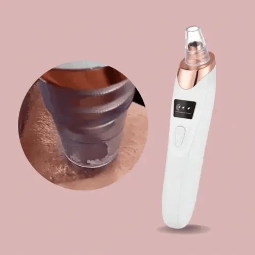 Nano Electrical Vacuum Blackhead Remover — Unleash your radiant clear skin without pain or stress