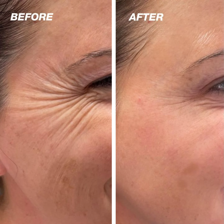 LumeniSkin — Put an end to blemishes and radiate confidence!