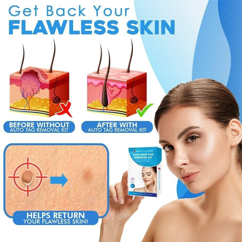 SmoothZap — Pain-free skin freedom for a new sense of confidence in just 10 days