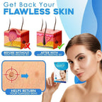 SmoothZap — Pain-free skin freedom for a new sense of confidence in just 10 days