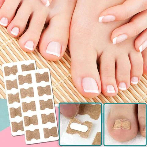 ALIGNSTRIP – Painless Nail Correction Strips for Ingrown & Deformed Nails