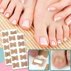 ALIGNSTRIP – Painless Nail Correction Strips for Ingrown & Deformed Nails