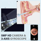 AURIVIEW – Smart Ear Cleaner with HD Camera