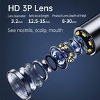 AURIVIEW – Smart Ear Cleaner with HD Camera