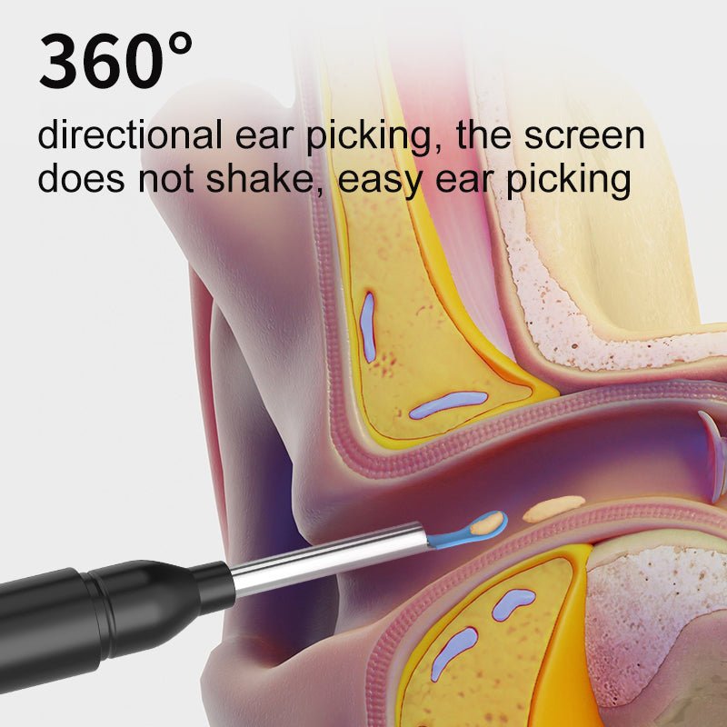 AURIVIEW – Smart Ear Cleaner with HD Camera