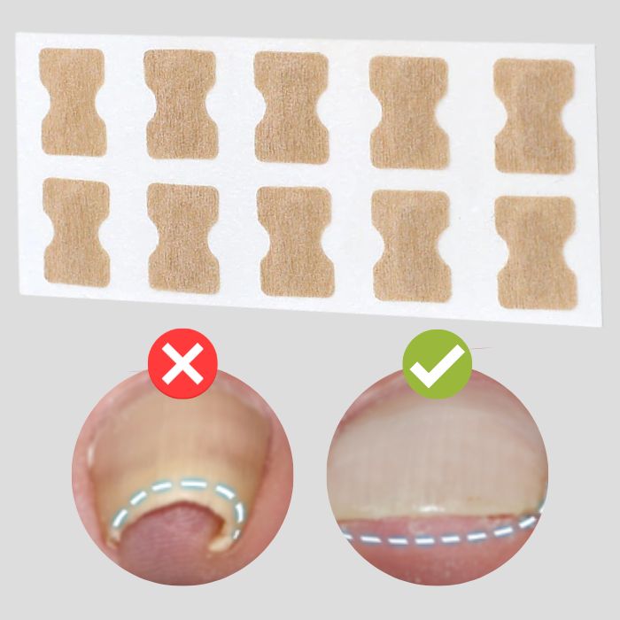 ProFlexiPatches — Pain-free natural nails that you show off again with pride