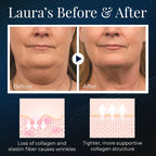 BeautyRest+ Sleeping V-Face Beauty Device