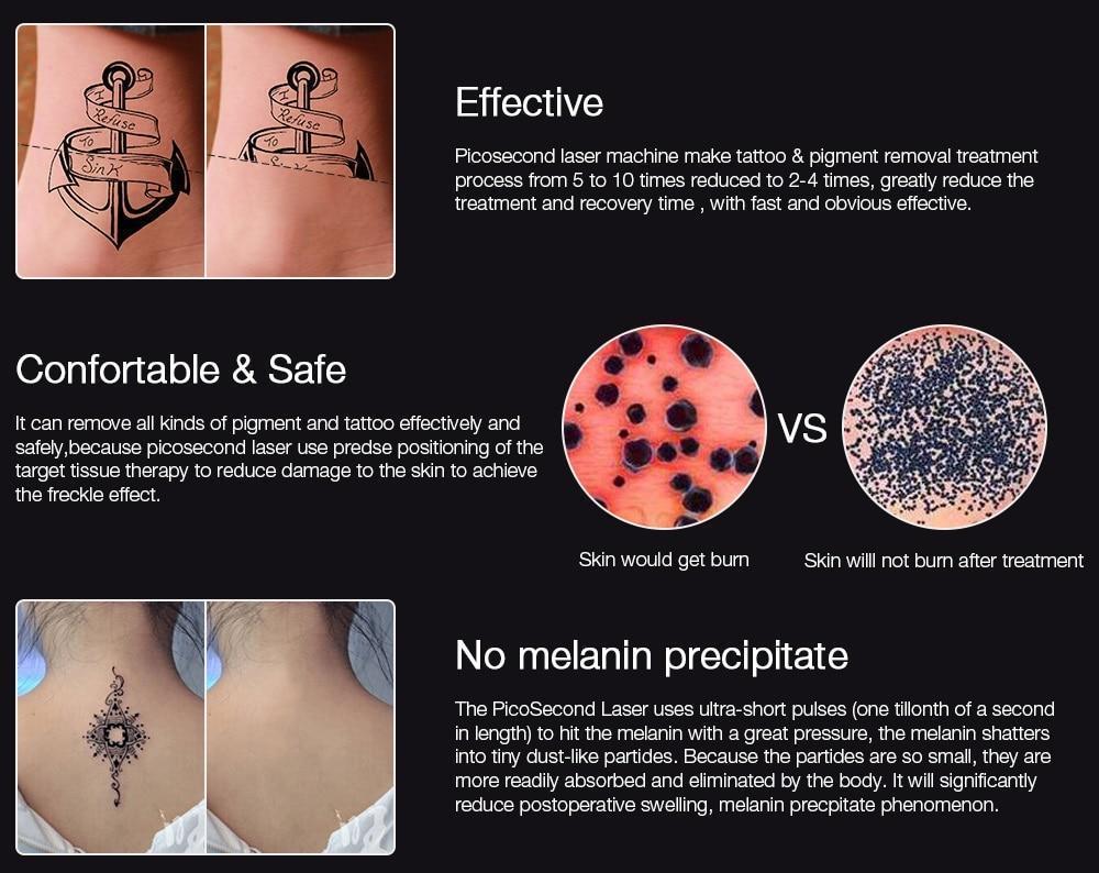 Laser Removal Pen for Dark Spots, Tattoos, Moles and Skin Tags