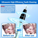 BuddyCare Ultrasonic Pet Dental Cleaning Kit