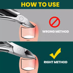 Orthopedic Nail Clipper