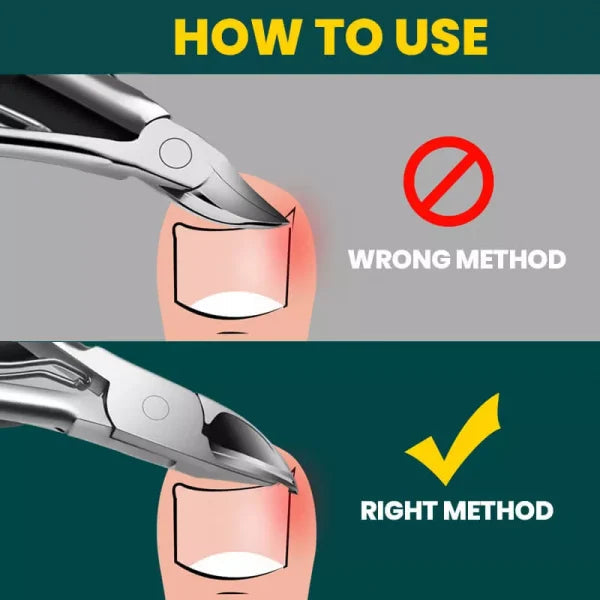 Orthopedic Nail Clipper