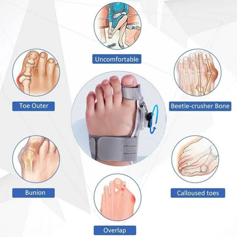 Gentle toe correction for bunions