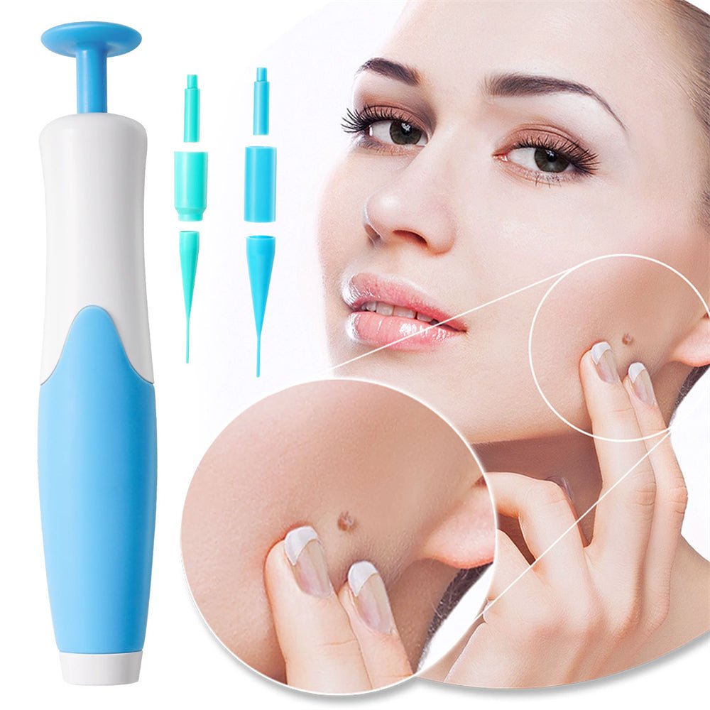 EPICLEAR – At-Home Skin Tag & Wart Remover Kit