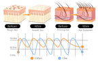 Professional High-Frequency Facial Wand – Anti-Ageing & Skin Rejuvenation