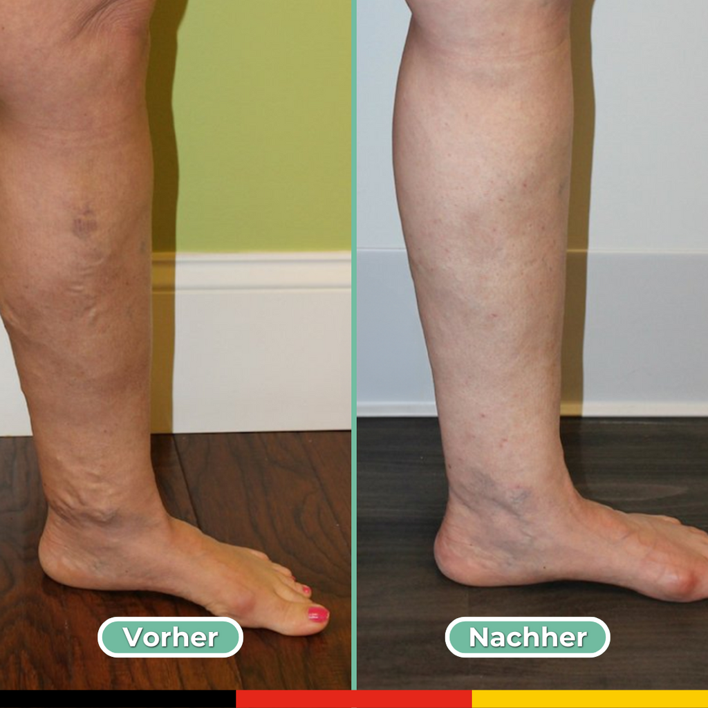 4-in-1 Leg Relief Massager